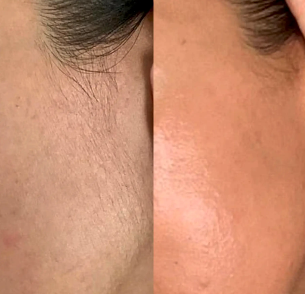 Cosmetic Tattoo