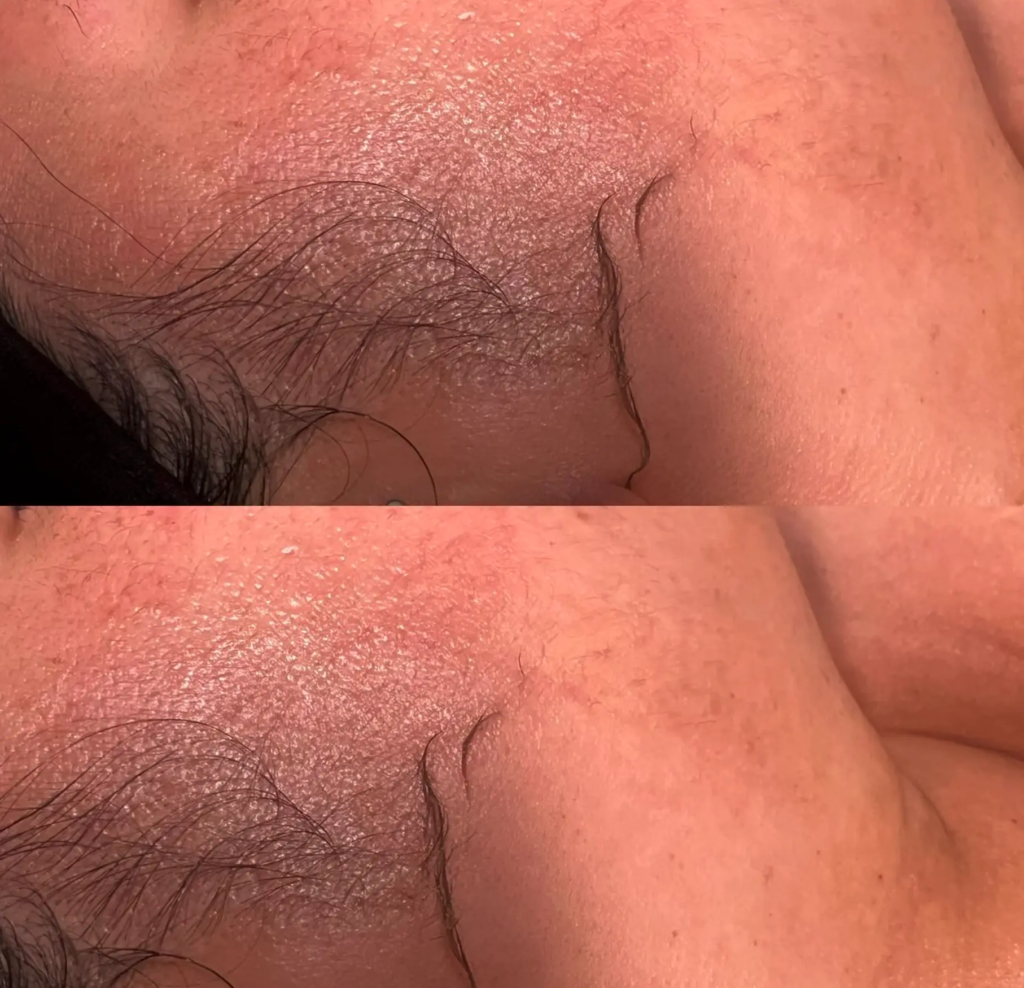 Is It Safe for Facial Hair