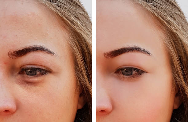 Before and after comparison of eyebrow microblading treatment on a woman