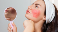 Woman applying moisturizer with a stinging sensation on her face